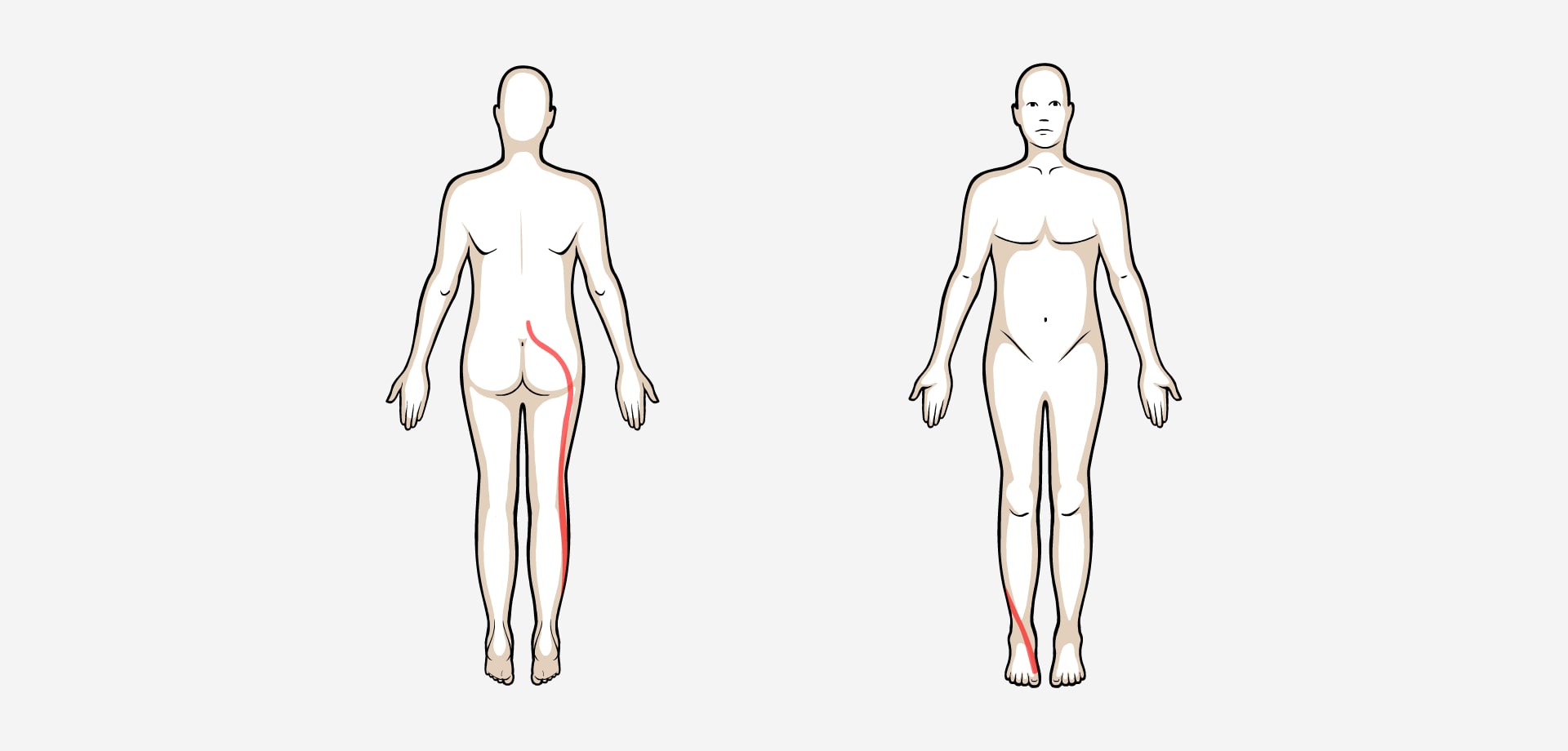 Dolor punzante en espalda y piernas